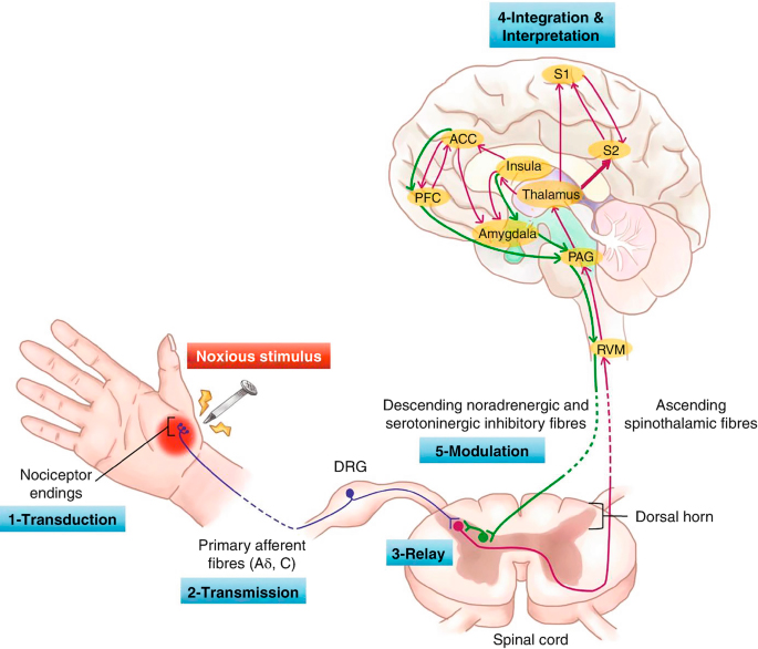 cerebro dolor